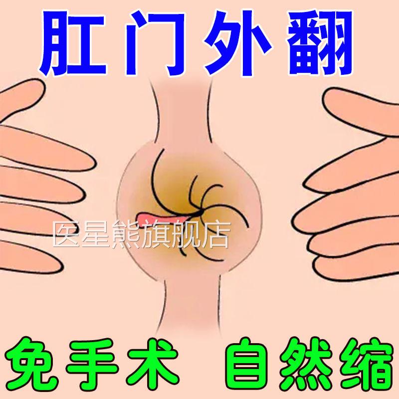 自脓回缩】肛门外翻肛门疼痛肛脱肛周肿肛门瘙痒肛门出血肛周松弛