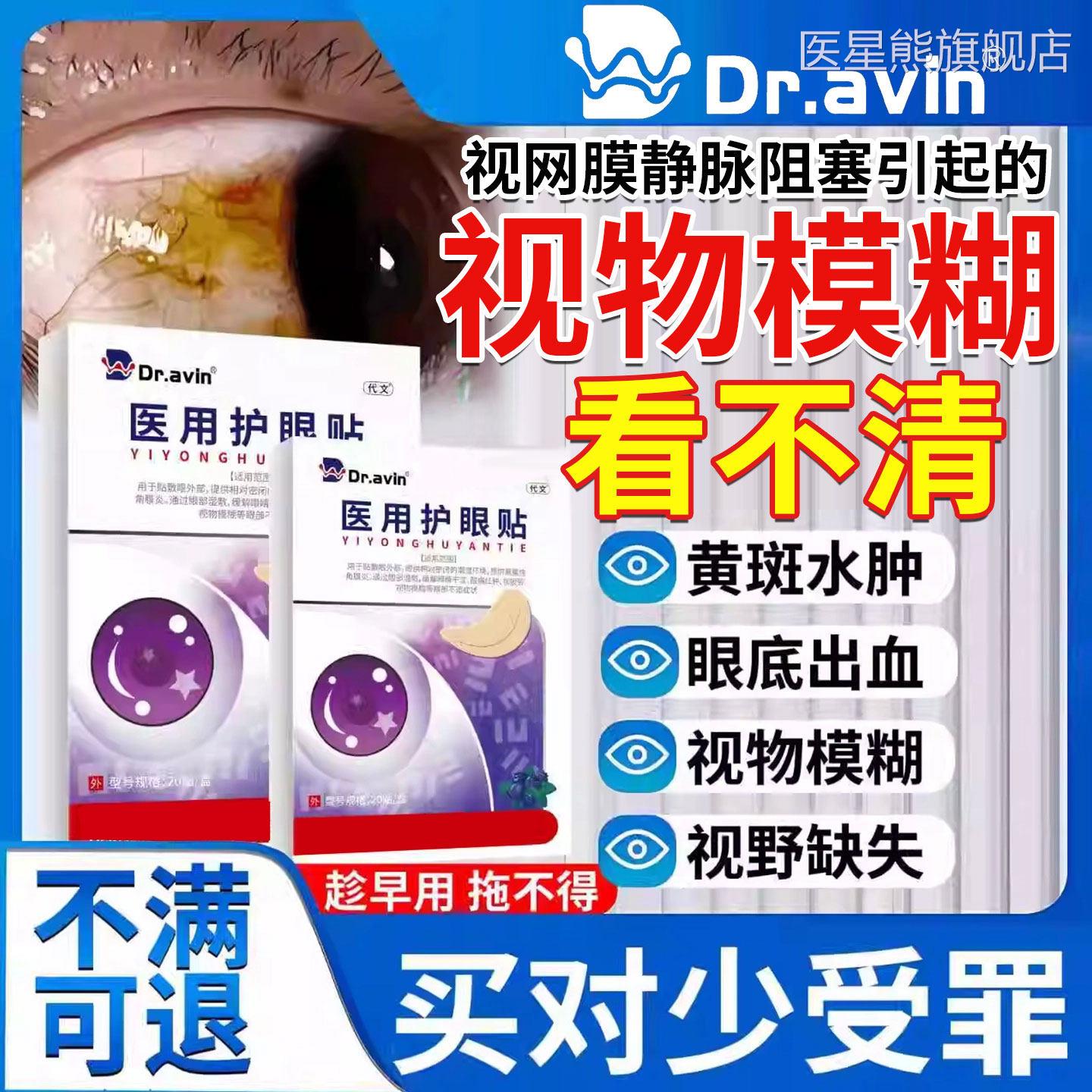 视网膜静脉阻塞眼叶底黄斑病变出血眼去除睛水肿黄素冰敷眼贴CA医