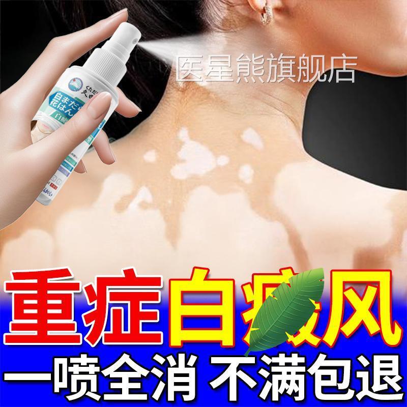 白殿净白风净克星生汗斑白色净汗斑补骨脂酊外用黑色素中老年专用