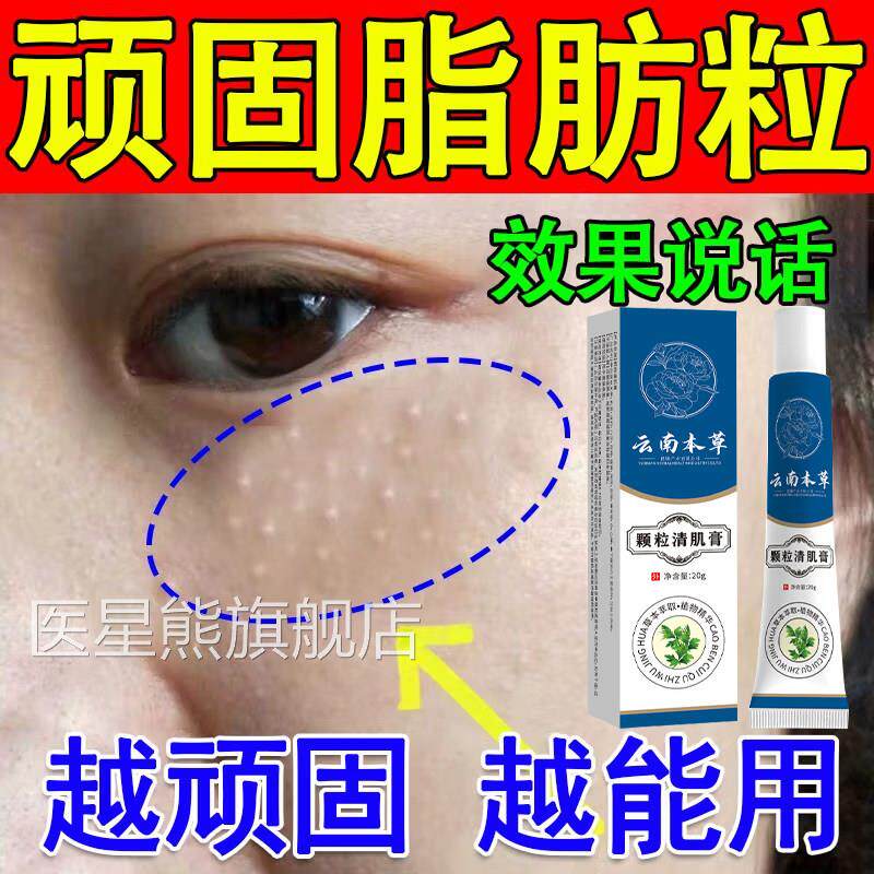 云南本草颗粒清肌膏官旗舰店男女通用眼周脂肪去除方粒神器正品医