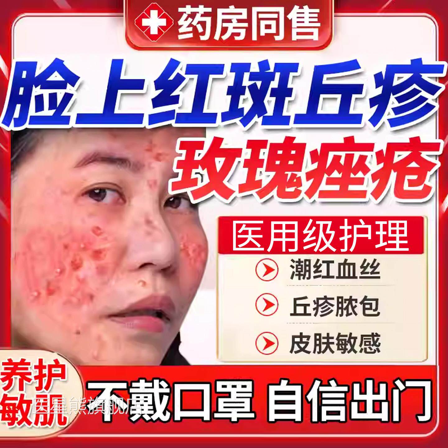 药房同售玫瑰痤疮屏障修复护面膜软膏内调专用肤品面霜退红疹烫SK