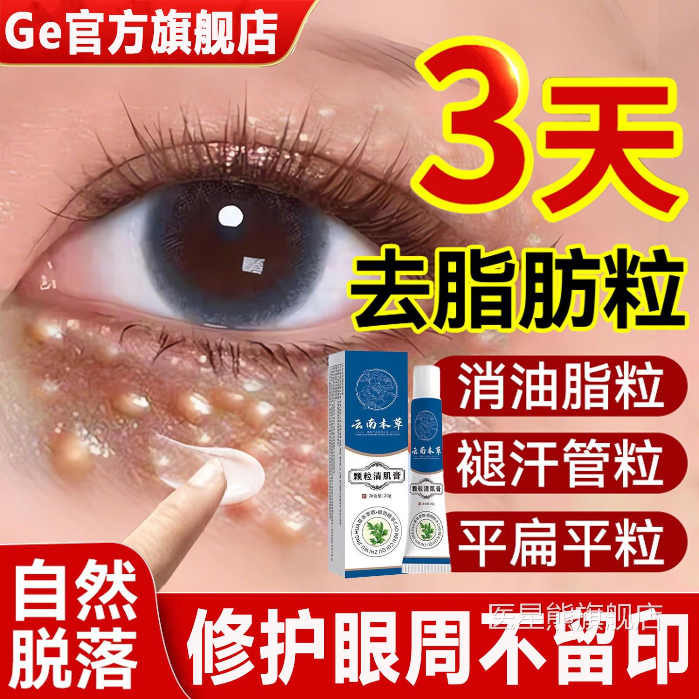 云南草颗粒清肌膏脂肪粒眼周专用去本小颗粒眼霜正品官方旗舰店医