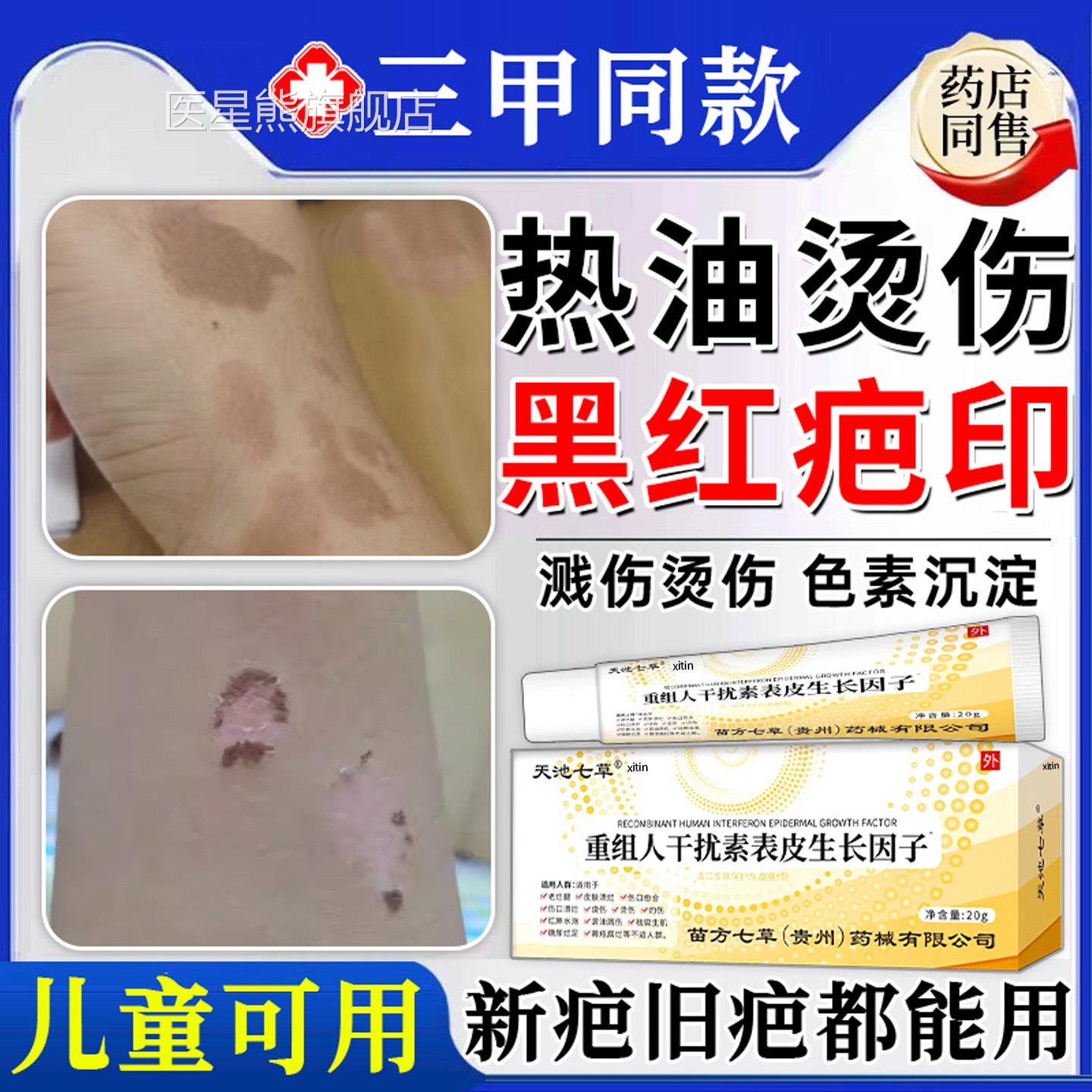 热油油烫伤烧伤去疤膏疤痕修印复除疤膏儿童祛去红黑印色素沉淀医