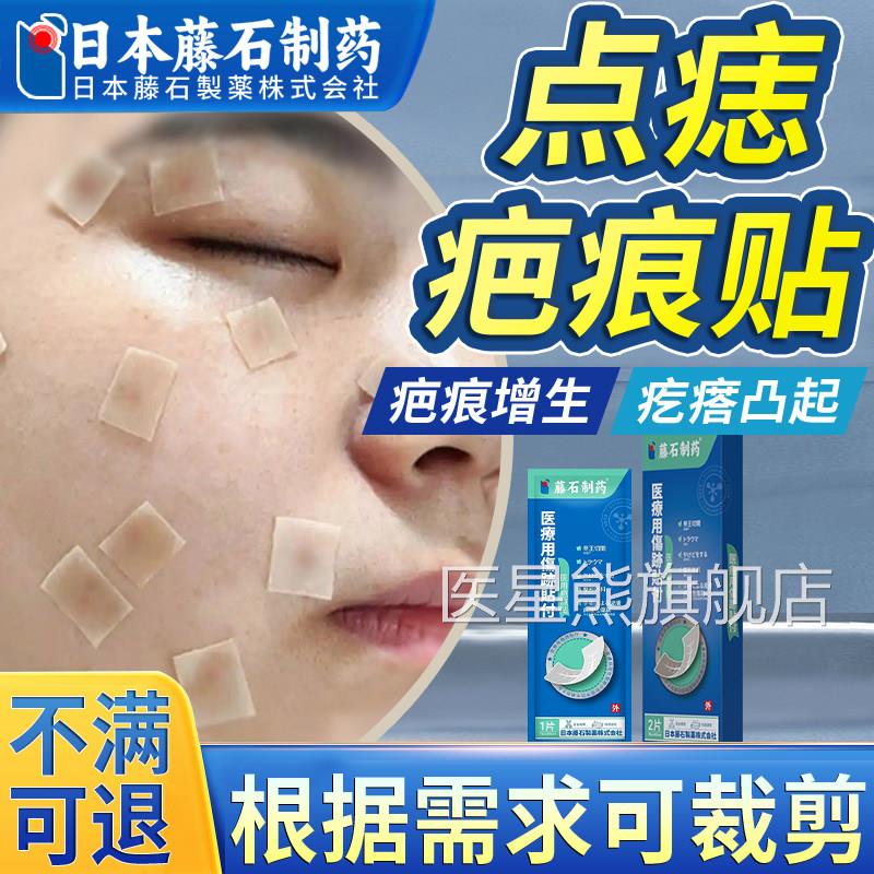医用上祛痣去痣点痣后脸去疤痕祛疤贴修除疤膏增生凸起去疙瘩OM医