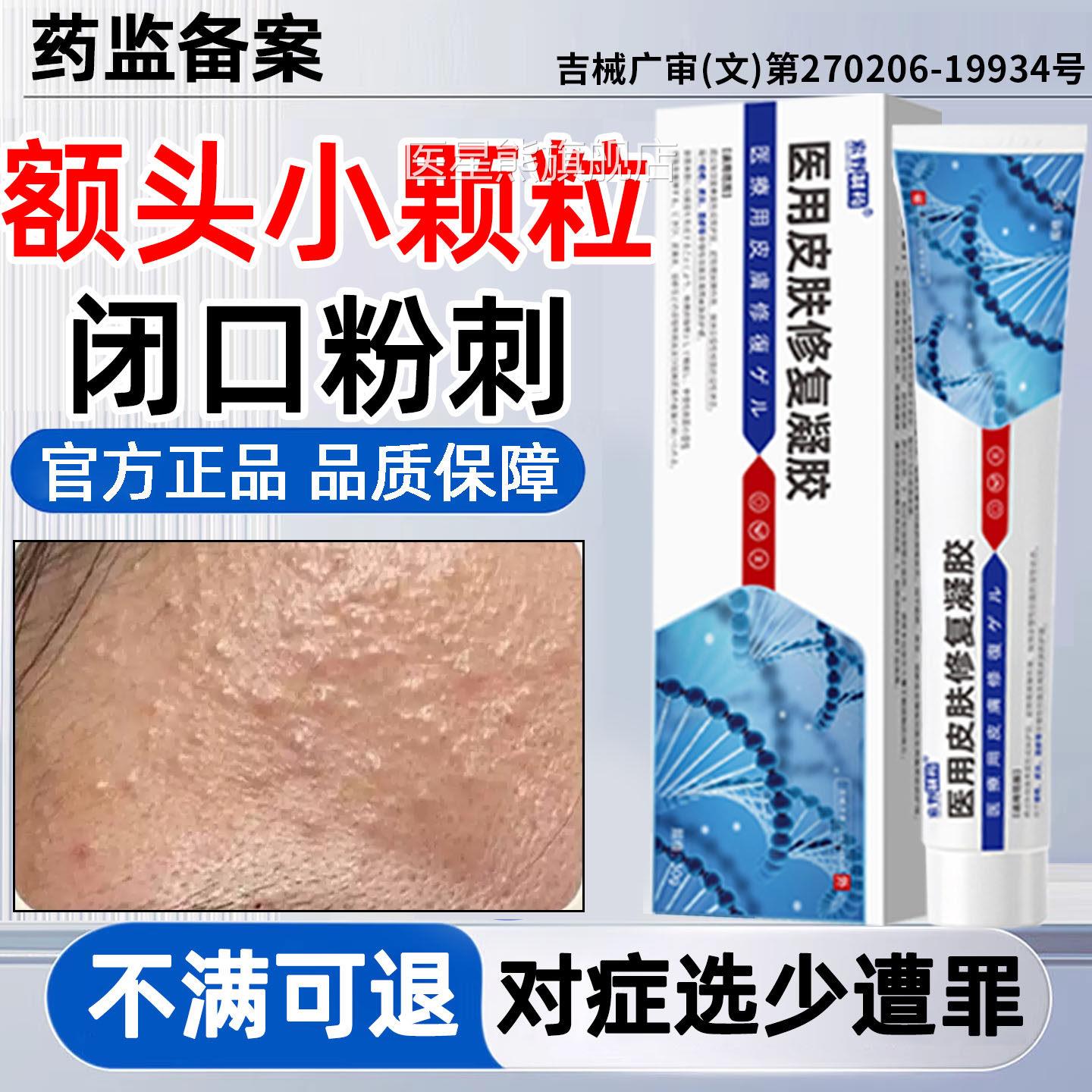闭口粉刺小颗粒脸面部逆光疹儿童脸上起小疙瘩屏障受损塞毛囊堵QQ
