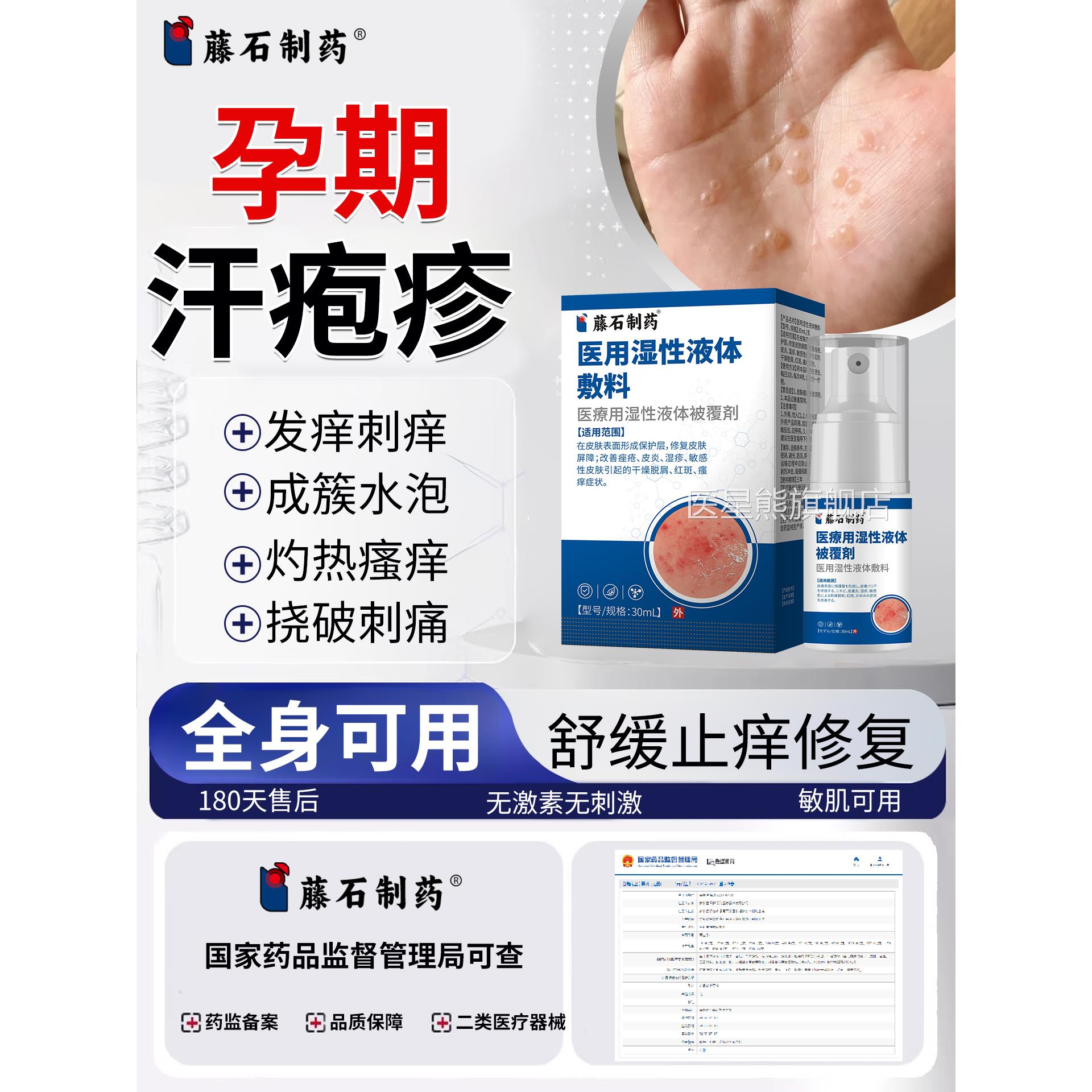 孕期汗疱疹湿疹手脚起小水泡上专干裂脱皮真菌感染用瘙痒搭膏药ZF