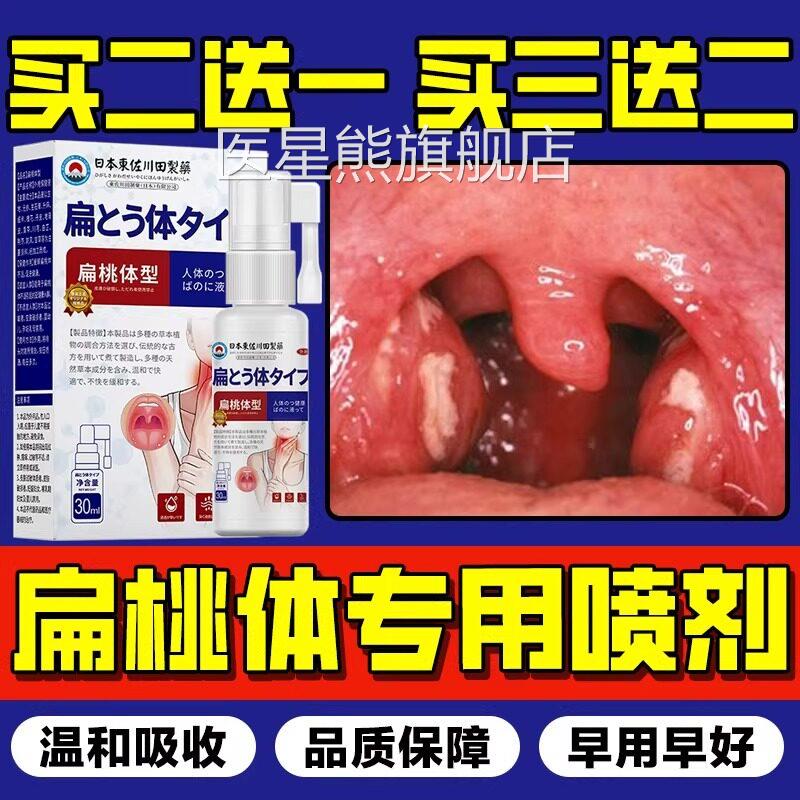 日本特扁桃体结石去除工具漱口水喷雾剂效溶解隐窝冲洗器清理喷剂