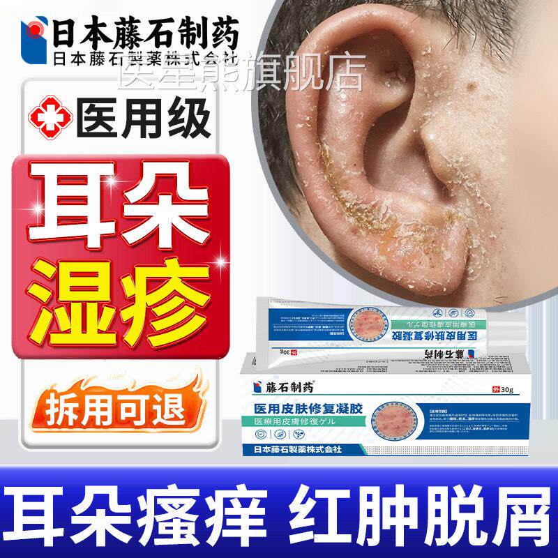耳朵里湿疹真菌感染专用面瘙痒外耳道去湿除止痒根膏药监备案OM医