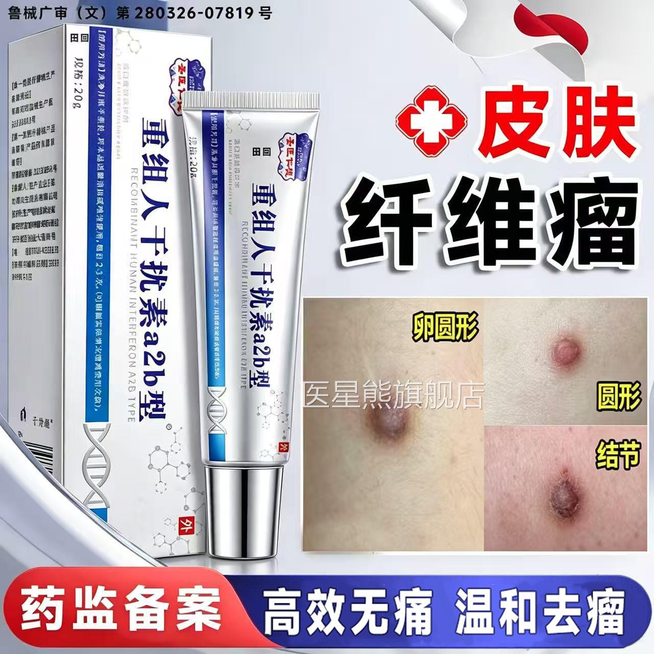 皮肤维瘤去除药膏硬块疙瘩结节皮下肿硬块脂肪消瘤医用贴神器纤LT