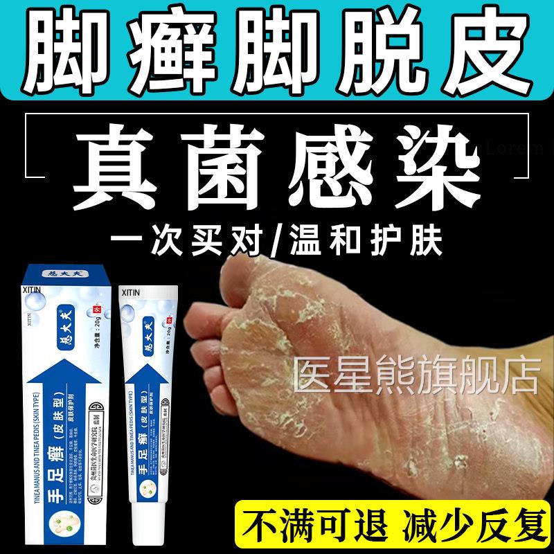 角化型足癣脚癣一旗次净官方舰店脚脱皮干裂真菌感染贵州神奇止UU