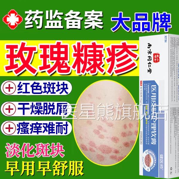 玫瑰糠疹专用软膏皮疮肤瘙痒红斑痤屏障修复红斑鳞屑皮炎湿疹UU医