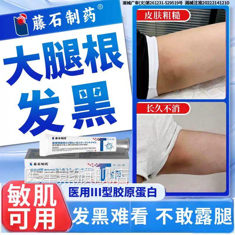 大腿内侧黑素沉淀色去除根部私处皮肤黑摩擦发黑专美白去黑用膏CA