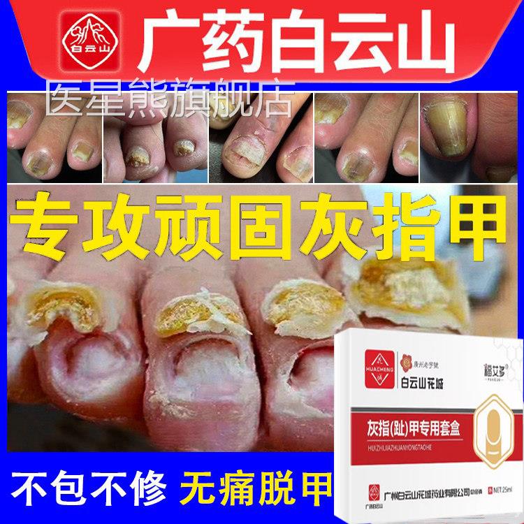 白云山正品灰指甲专用液治疗真菌感染甲癣手足癣抑菌脱甲效特医星