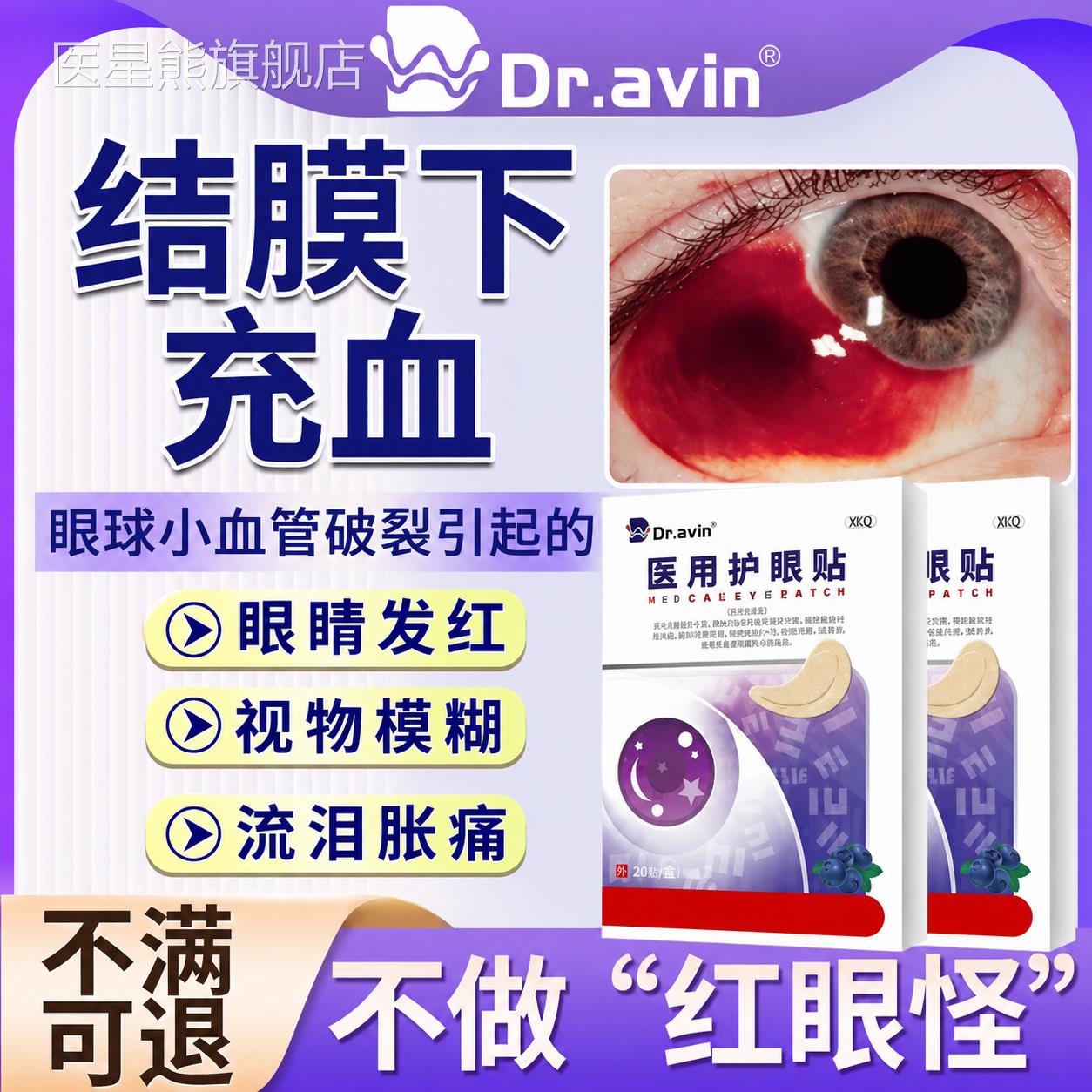 结膜下出血眼底充血眼贴眼角眼有睛血块血管破裂血糖高眼模糊SK医