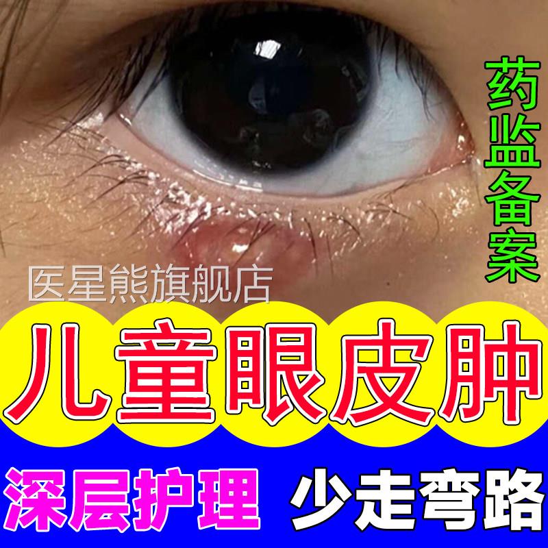 眼睑板堵塞疏通器儿童眼蒸汽罩霰粒肿眼皮消肿麦粒肿热敷眼贴QQ医