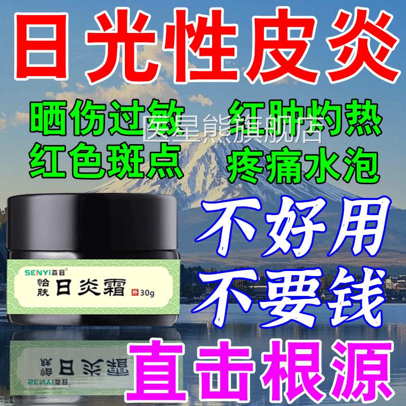 日光性皮炎紫外过敏晒伤瘙痒防晒修复膏皮肤晒黑干痒线起皮脸部医