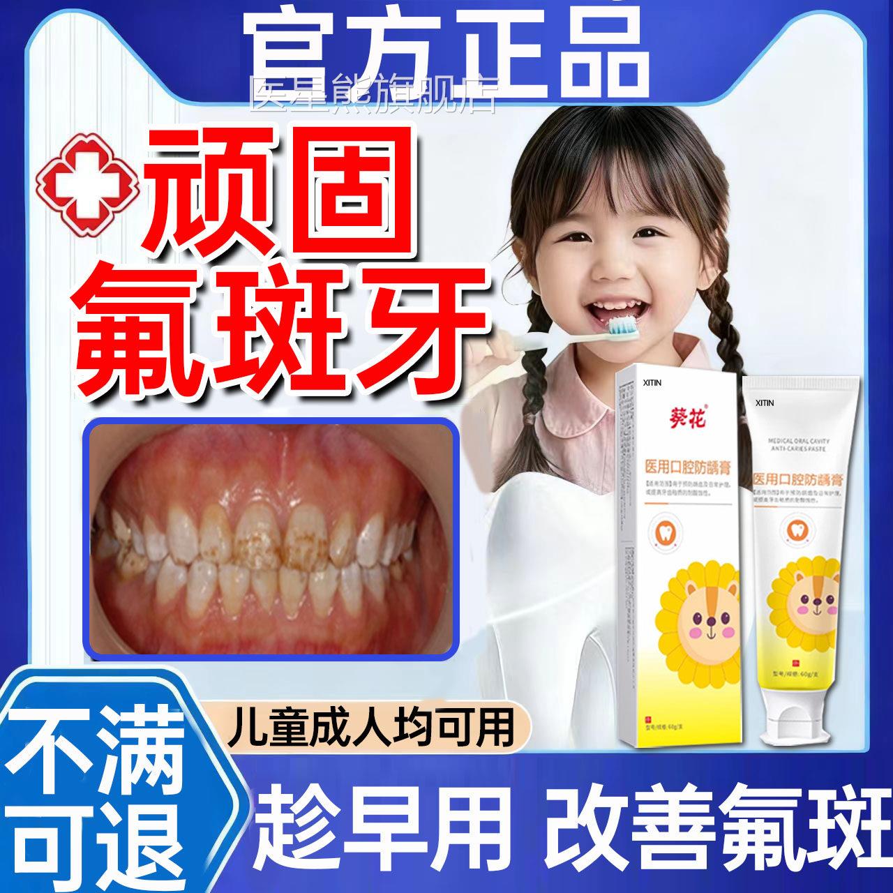 氟斑牙去除专用牙膏变白神器祛稀盐酸儿童牙齿白斑黄褐色牙菌斑PP