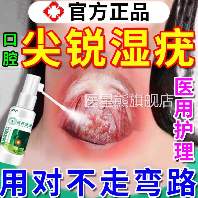 咽喉口腔尖锐湿疣喷雾专用鬼臼毒素酊抗hpv病毒自测干扰疡素溃UU