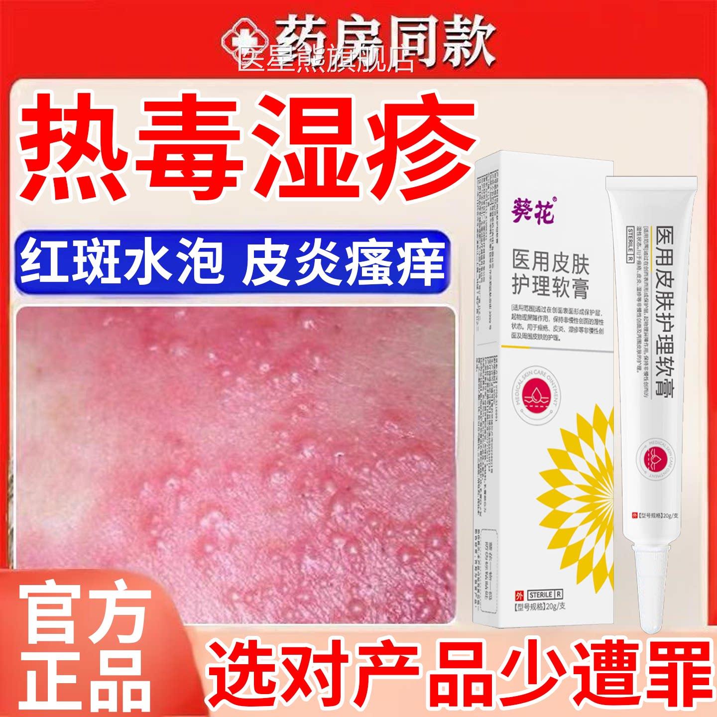 一热毒湿疹止痒专用膏除湿皮肤热就痒湿毒清软膏根湿痒皮炎水泡医