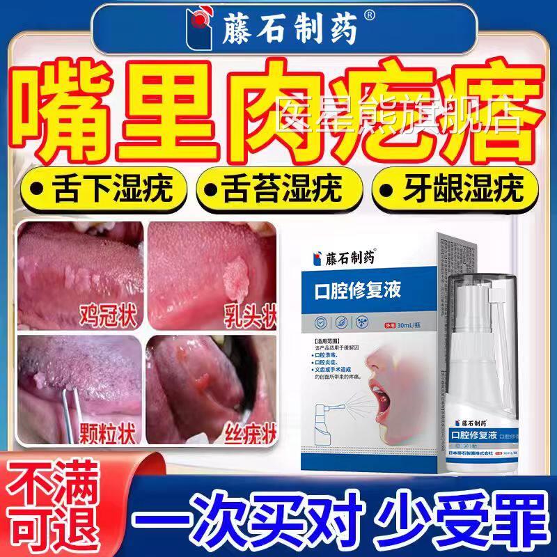 口腔尖锐疣湿专用男女性检测自检嘴里长肉疙瘩干扰素喷雾剂CA医星