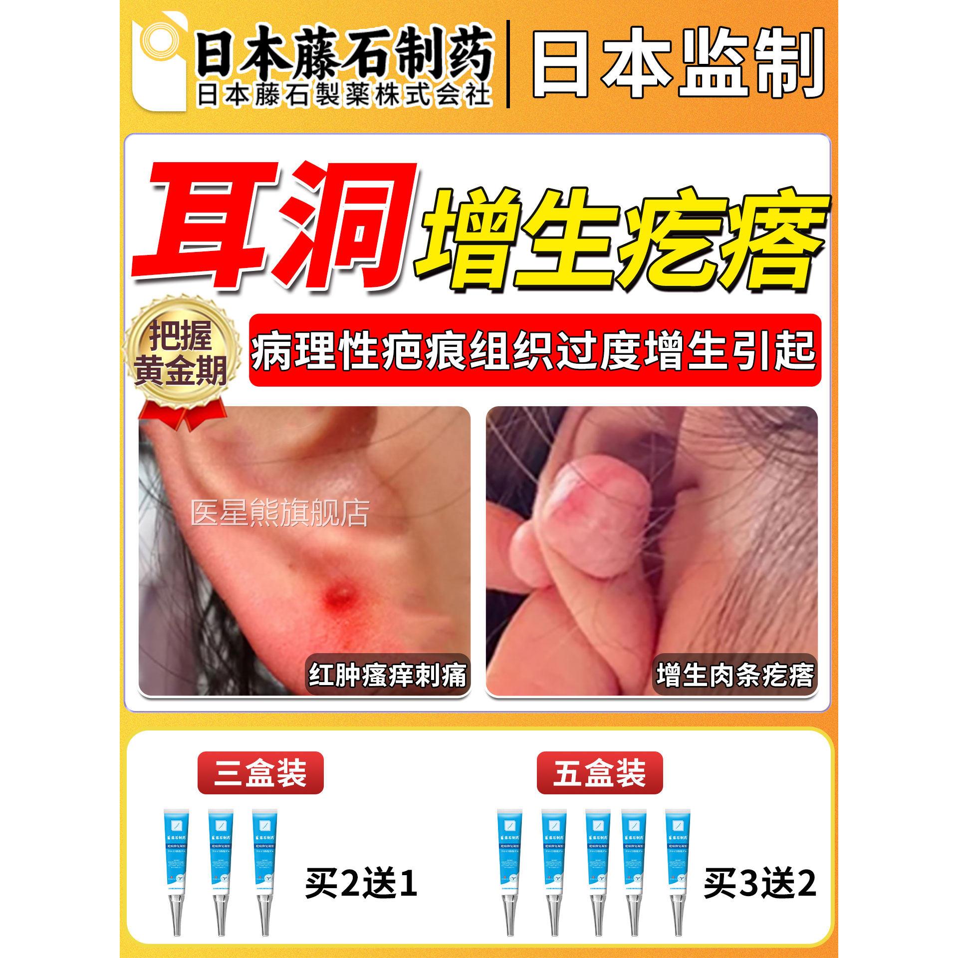 藤石制药耳洞增生疤痕疙瘩凸去硬肉除膏凝胶软化针起鼓包瘙痒OM医
