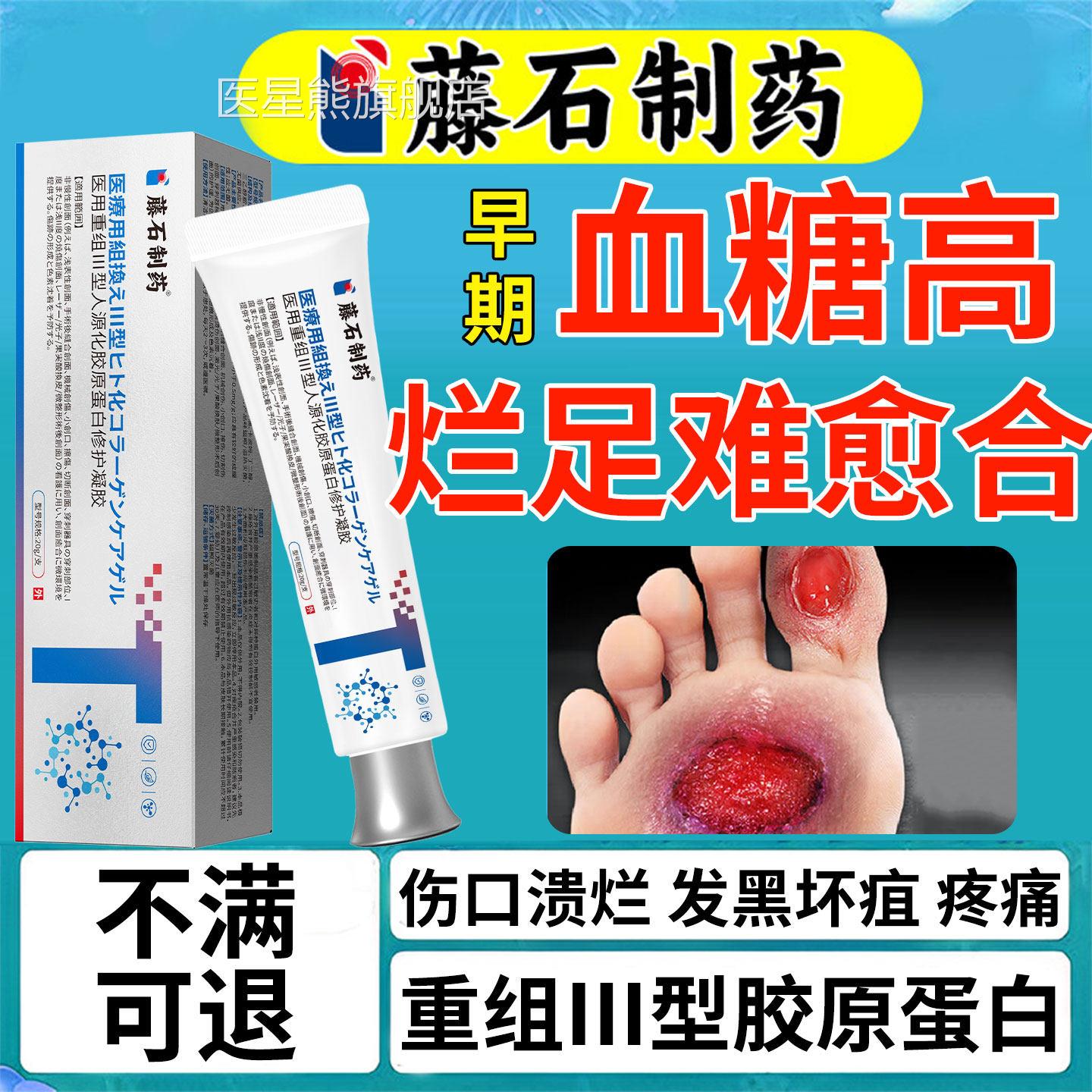 早期糖病引起烂足烂脚专用膏促进伤口愈合溃烂流脓腐药尿房同售SK