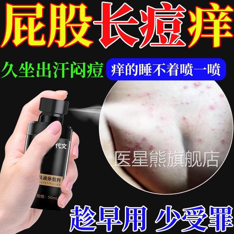 屁股上长痘痘痒起热疙瘩屁股湿C疹慢性股藓搭糖皮质激素软膏阴囊A