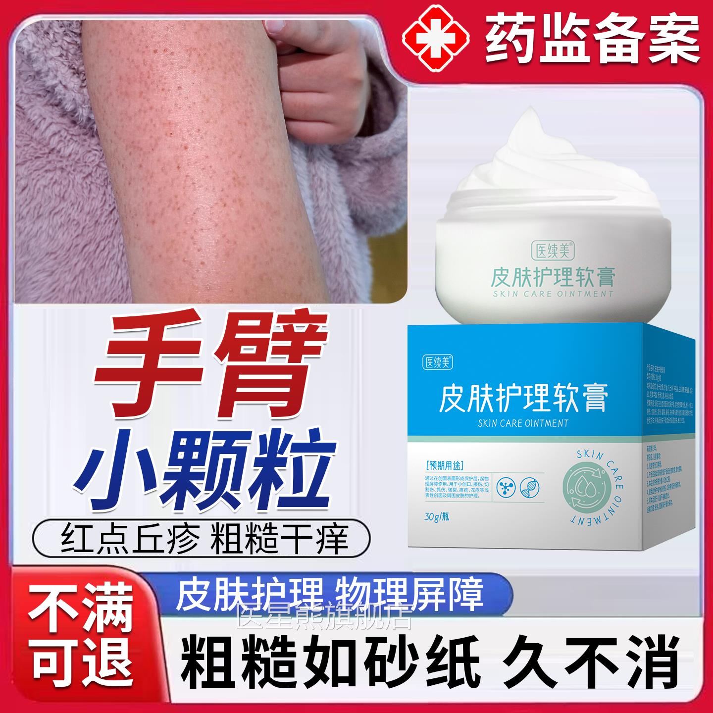 手臂胳膊上颗皮粒儿童鸡肤疙瘩毛囊角化症专用身体乳膏角质去除PG