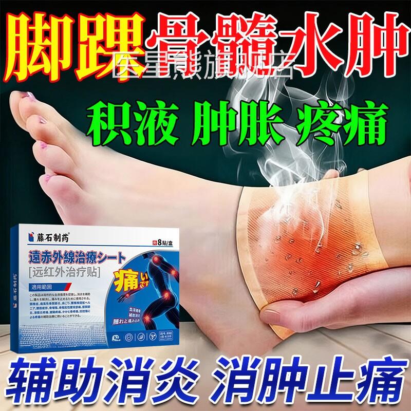 脚踝骨髓水肿关节积液韧带伤脚腕疼痛扭伤滑膜损炎膏药热敷贴CA医