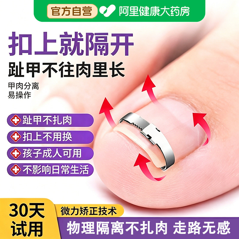 甲沟矫正器嵌甲矫正器脚趾甲卷指甲纠正神器正甲扣拉拉炎正甲贴片