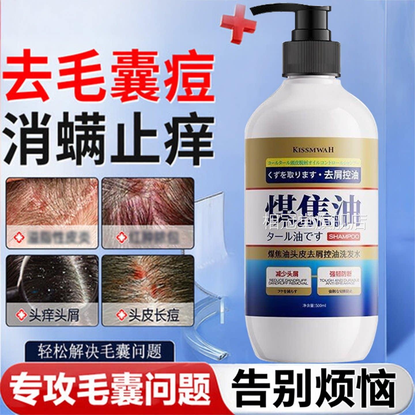 煤焦油洗剂去屑止痒洗发水头皮控油蓬松持久洗发露正方品官旗舰店