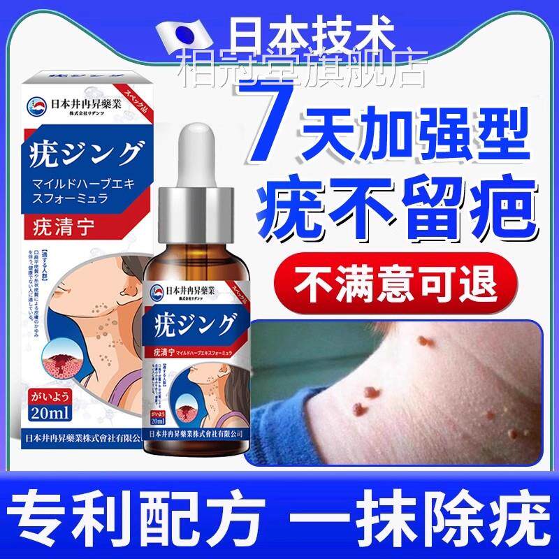 日本去疣液去扁上平疣丝状疣脖子去疣瘊小肉粒跖疣去疣专用神器相