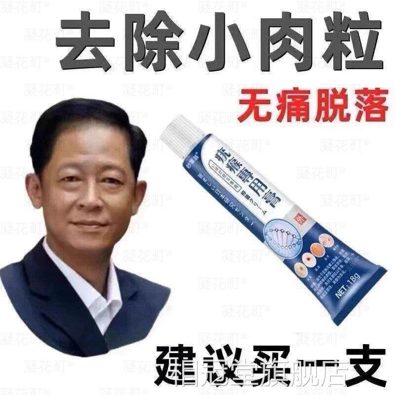 【日本进】特效去脖子小口肉粒腋下颈部全身疣瘊克星扁平尤专用膏