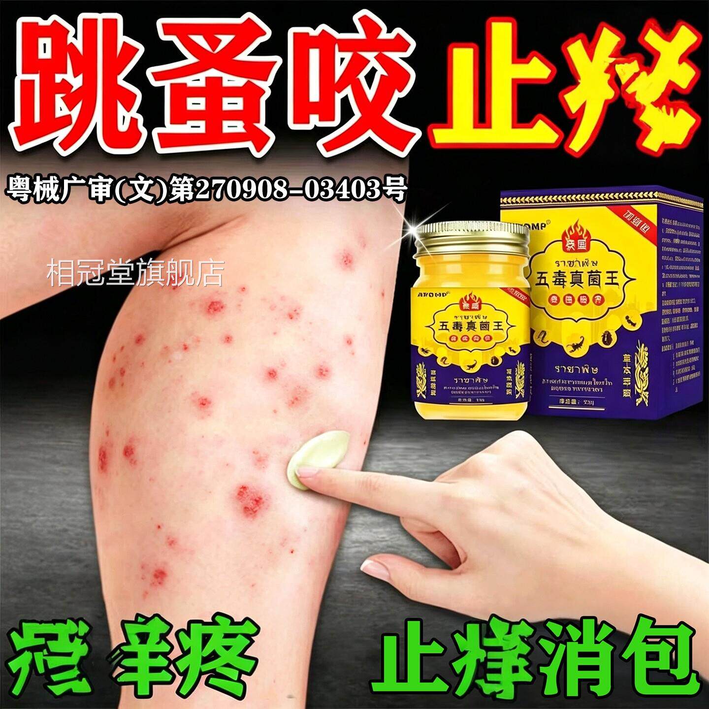 跳咬止膏痒瘙红痒肿蚤专儿童外用毒臭虫红蚂蚁皮肤过敏隐翅虫叮相