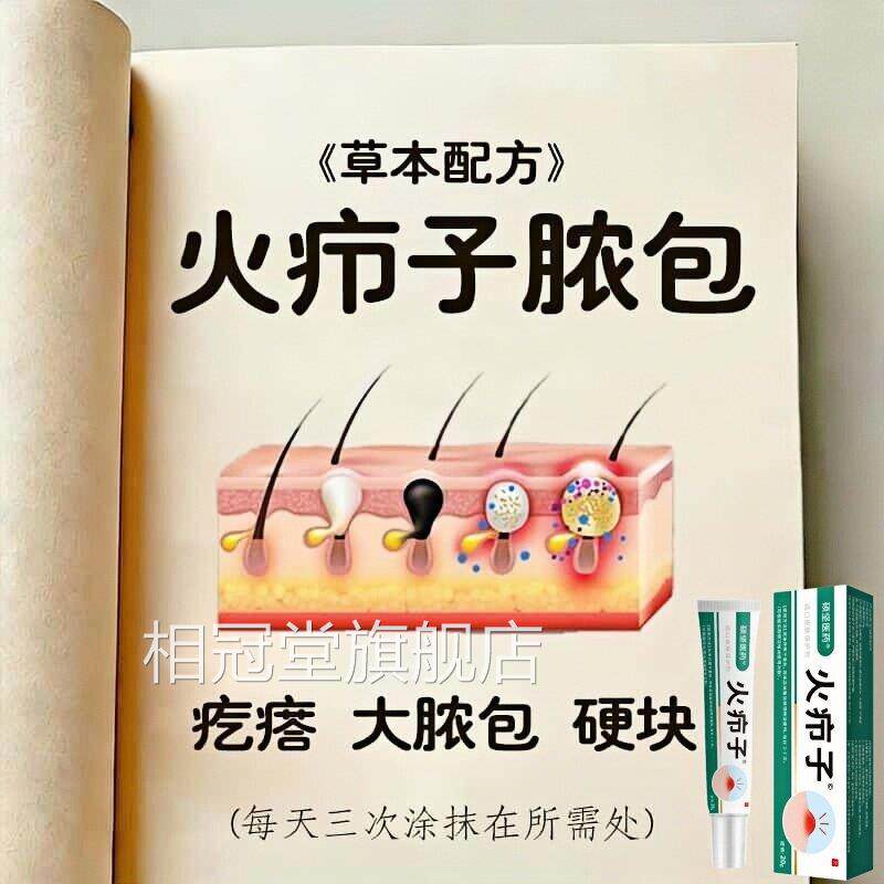 正品火疖子脓包坐板疮火疙瘩硬块肿发焱头皮毛囊硬红疙瘩毛囊净膏