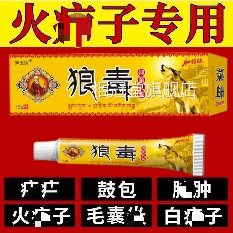 火疖子拔毒脓膏脓包硬块苗疆屁股长痤疮坐板疮拔红肿大脸部痘痘相