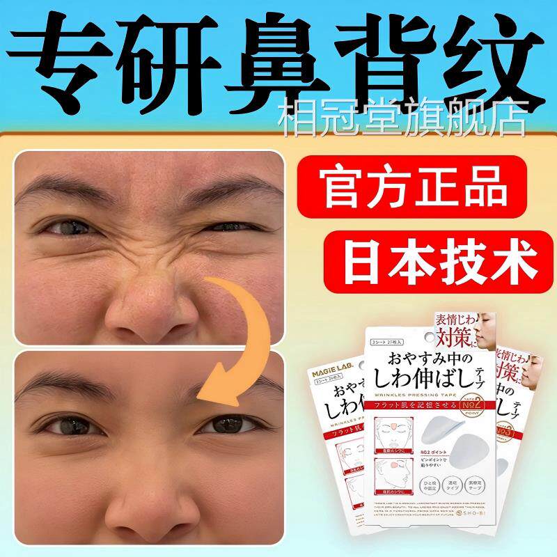 日本鼻纹去除脸上鼻梁横纹贴淡化背山根褶皱纹鼻子上有细纹路yy相