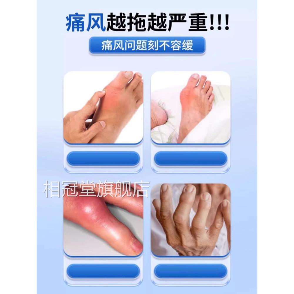 宝元堂痛风性关节炎敷疑胶医用凝胶止痛膏降尿酸疼痛溶石去结冷晶