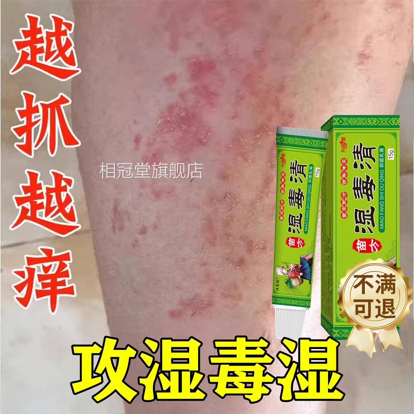 湿毒清软膏湿热止湿痒祛痒湿根皮肤皮瘙炎痒水泡治除用膏相冠堂旗