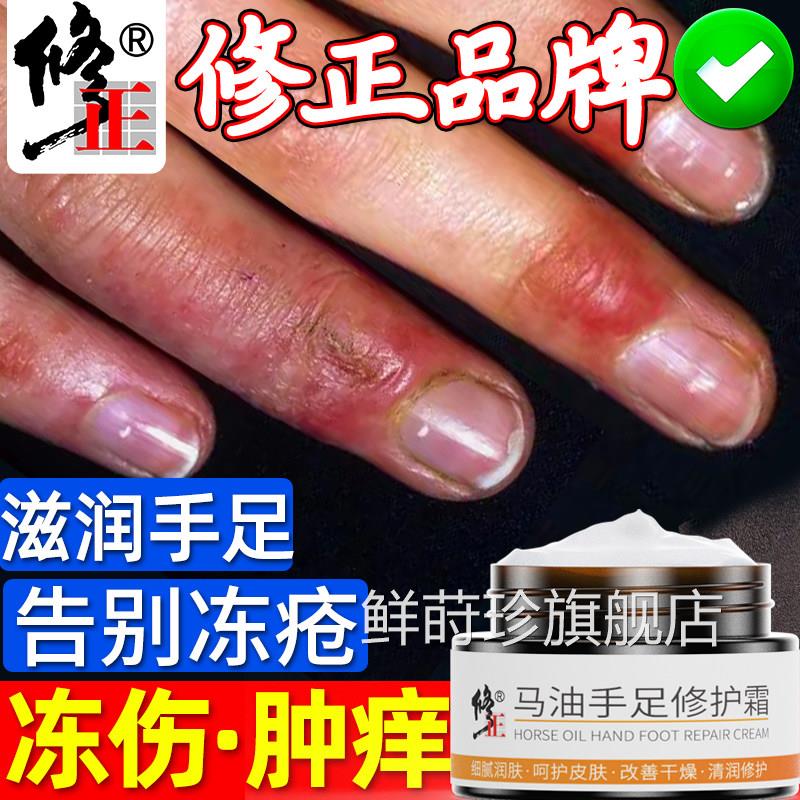 冻疮膏止痒冻伤膏正品儿童防裂口干裂油冻手耳朵消肿防冻马修复霜