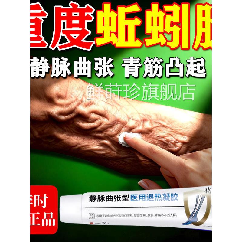 静曲张专用膏药贴脉蚯蚓腿疏通血管腿堵塞青筋红血丝医用冷敷凝胶