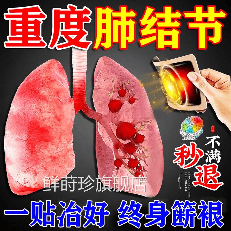 肺结节效特药槲皮清肺散结节丸肺结素节消除的药磨玻璃去小结节贴