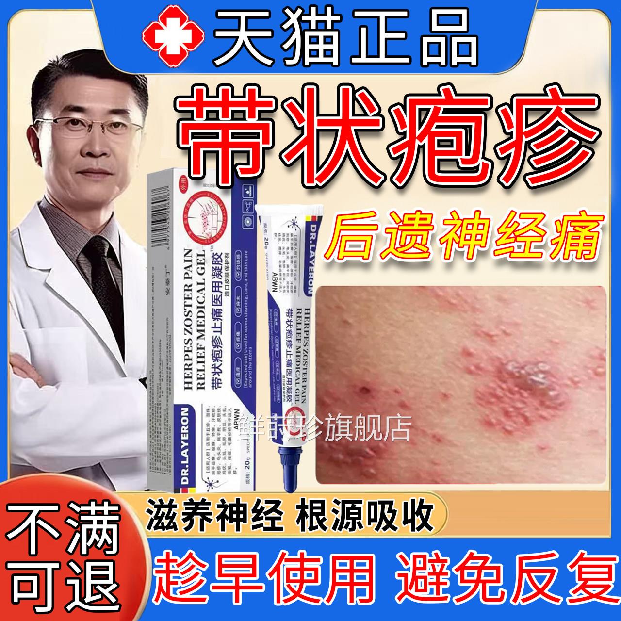 带状疱疹后遗症膏神经痛特药效蛇盘疮专外用快速止痒治灼热刺痛根