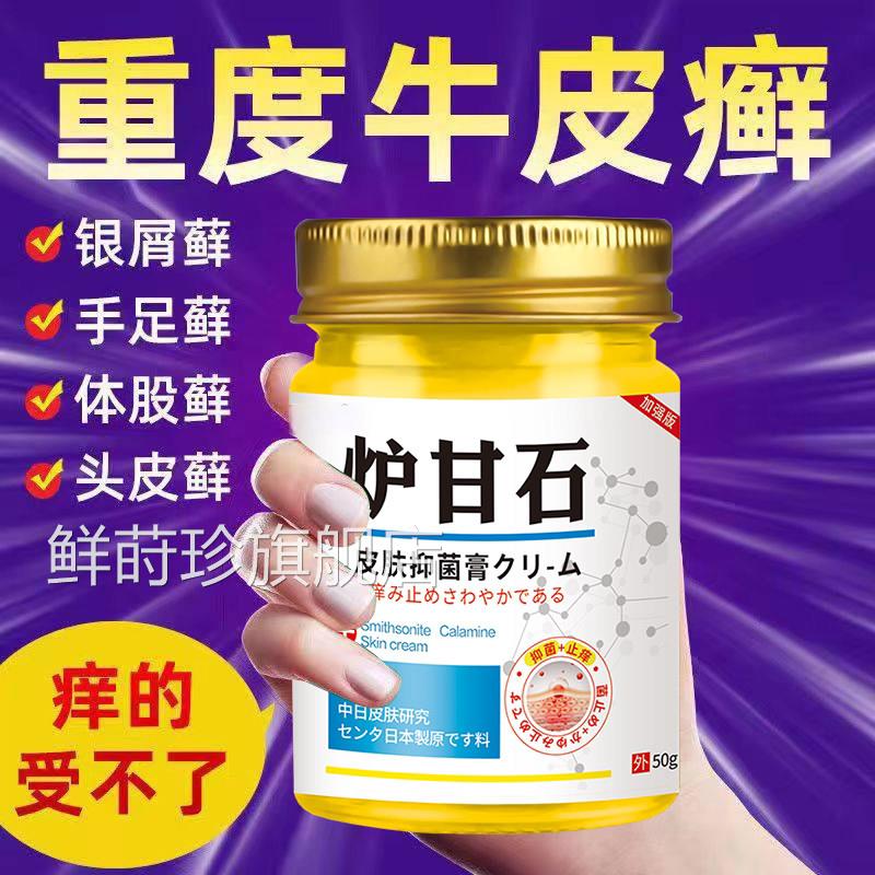 日本进口止痒王炉甘石皮肤瘙痒止痒膏肤干燥痒抑全身天然草皮本鲜