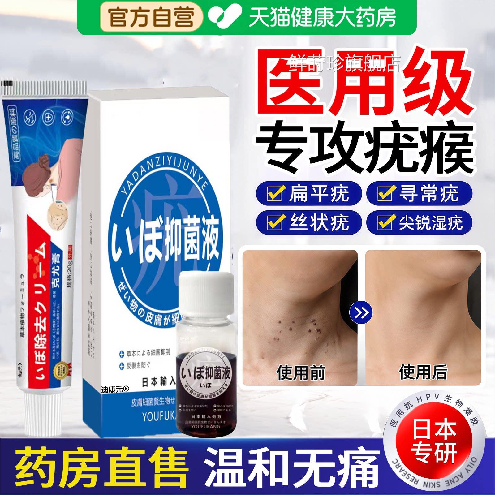 日本医用去优侯肉小粒平扁优凝胶脖子上长丝状疙疣瘩一抹灵软药膏