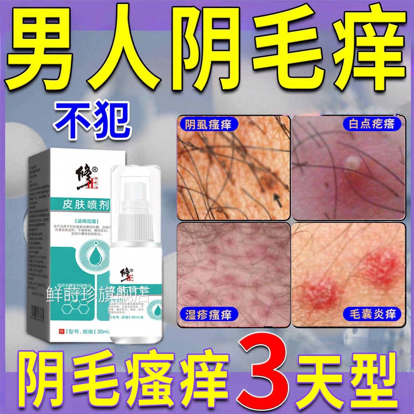 男性下体阴毛处瘙痒私处毛囊炎疙瘩阴消囊潮湿专用止痒抑菌膏药鲜