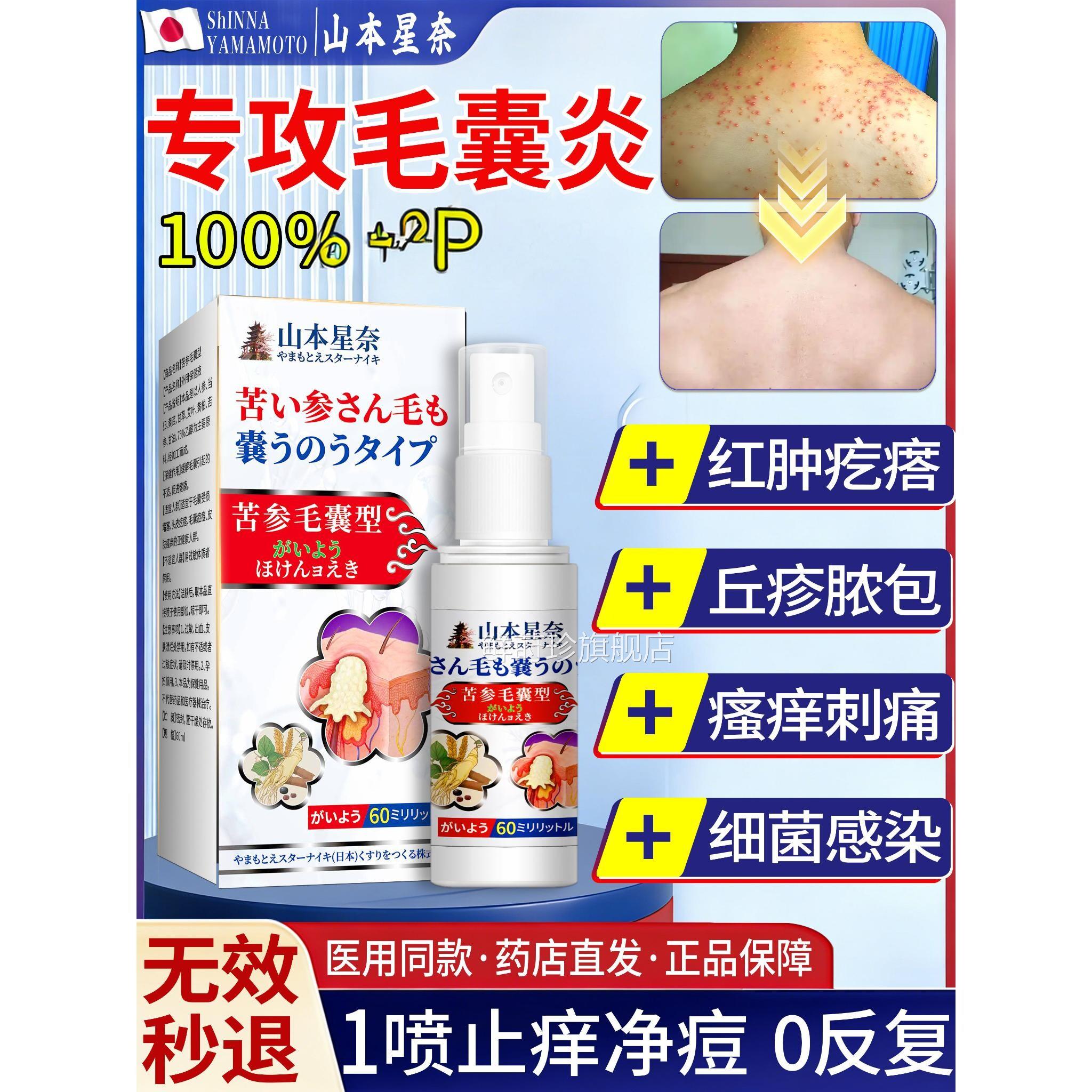 马拉色菌胸后背身上前长痘痘后背医用去除背后毛囊炎止痒祛痘喷雾