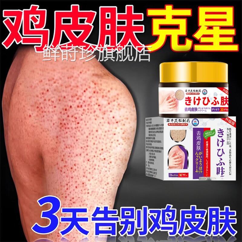 日本去臂鸡皮肤鱼鳞疙瘩毛囊角化症角质膏用手身体去除器永鲜莳珍