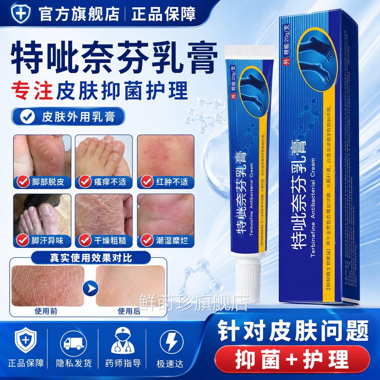 特呲奈芬乳膏店官方旗舰正品脚臭脚汗脱皮瘙痒止比萘抑菌软膏非药