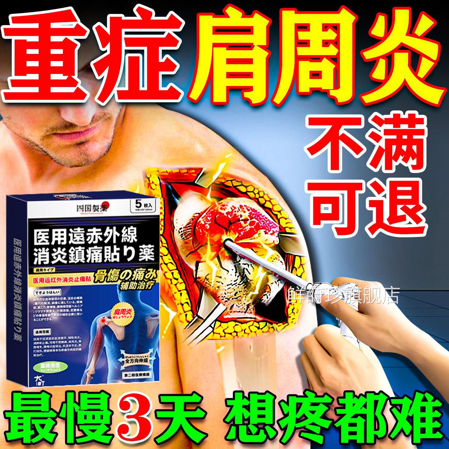 肩周炎专用膏肩膀疼贴痛贴抬臂无力远红外贴膏神器肩周劳损消炎贴